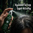 Capixy Advanced Leave-In Treatment Spray for Dandruff & Itching - 120 ml