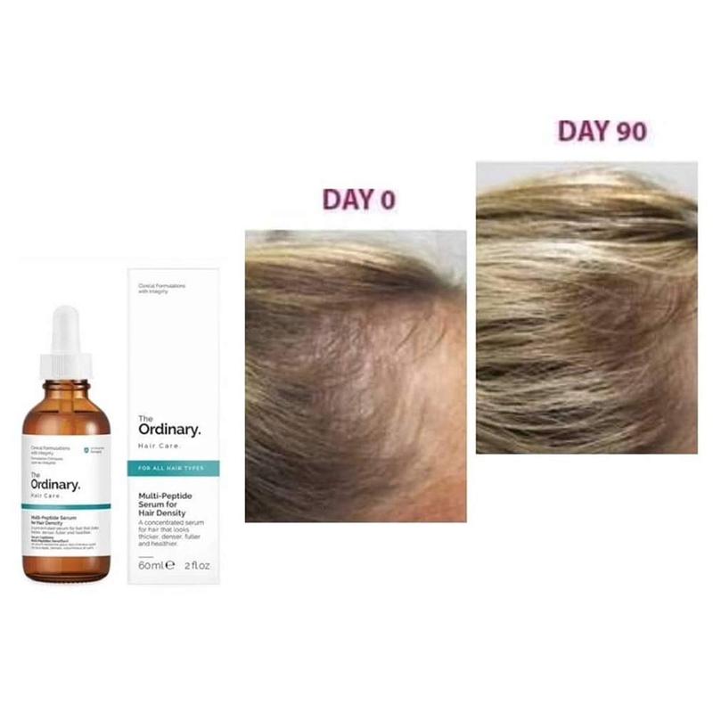 The ordinary سيروم مالتي ببتايد لزيادة كثافة وسمك الشعر 60